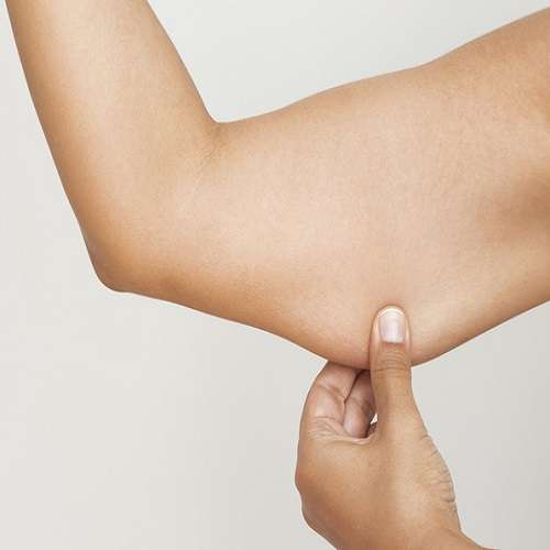 Woman pinching upper arm skin