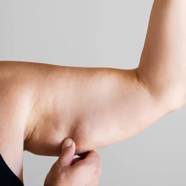 fat-dissolving-injections fat-dissolving-injections